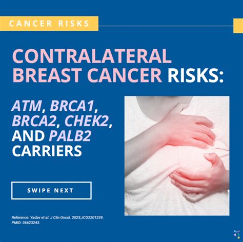 Icare Social Media Post February 2023 Risk For Second Breast Cancer In