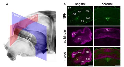 Postnatal Development Of Cerebellar Zones Revealed By Neurofilament