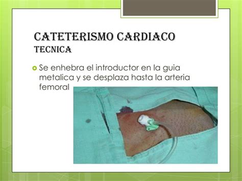 Cateterismo Cardiaco Ppt