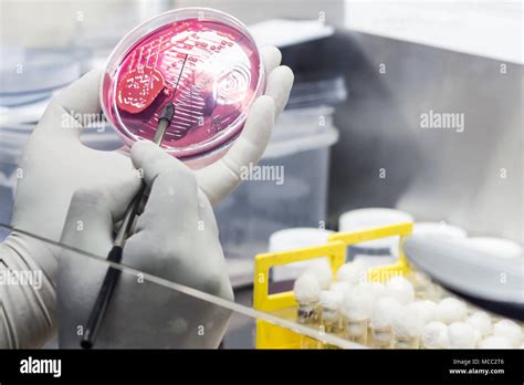 Inoculación bacteriana en una placa de cultivo mediante inoculación por