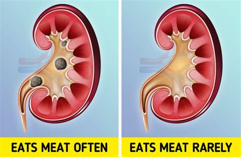 Kebanyakan Makan Daging Saat Lebaran Picu Masalah Kesehatan Waspada