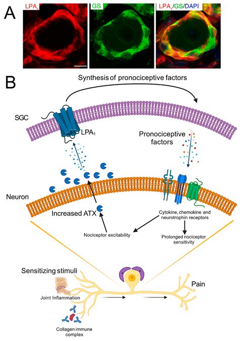 Cells Free Full Text Satellite Glial Cells In Human Disease