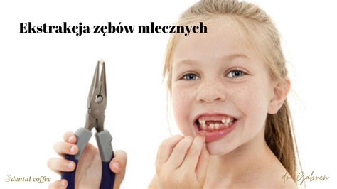 Planowanie ekstrakcji mleczaków w kontekście zgryzu Dental Coffee