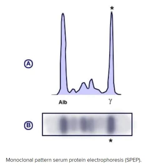 monoclonal gammopathy