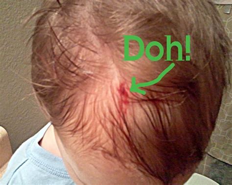 Head Gash Oliver 9810