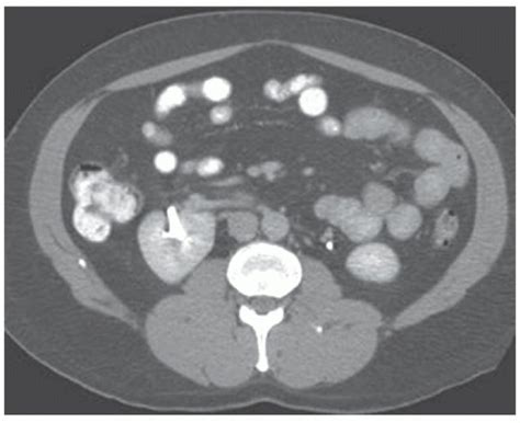 Congenital Anomalies Radiology Key