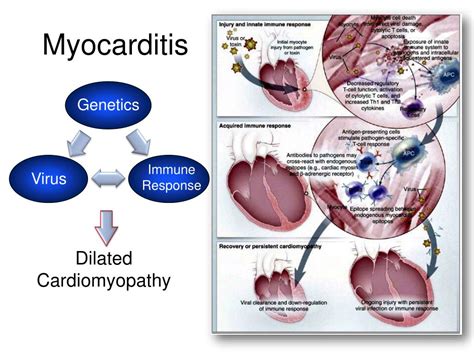 Ppt Cardiomyopathies Andre Keren Md Powerpoint Presentation Free Download Id 6954665