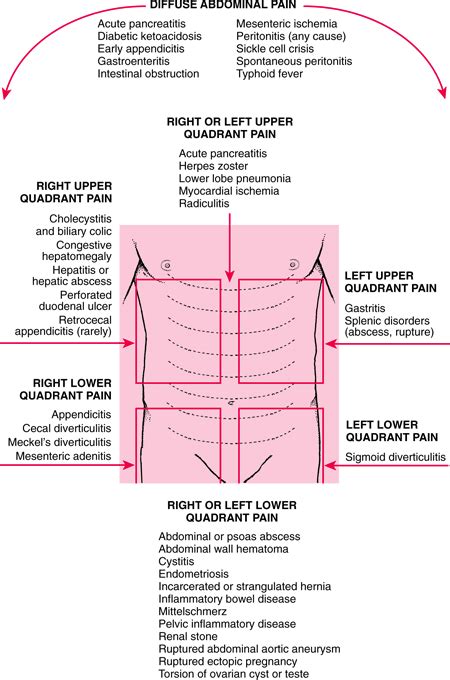 Medicalsham Differential Diagnosis Of Abdominal Pain