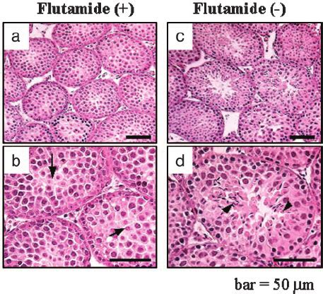 Representative Light Micrographs Of Testis Sections From Lurko Mice