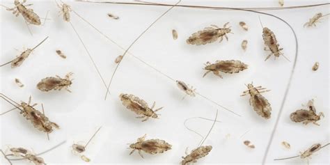 Lice Species Different Types Of Lice Species Pestworld