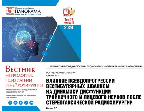 Радиохирургия Гамма-ножом | Доктор Сергей Ильялов | Gamma Clinic