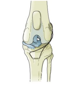 Cruciate ligament surgery - Granada Veterinary Clinic