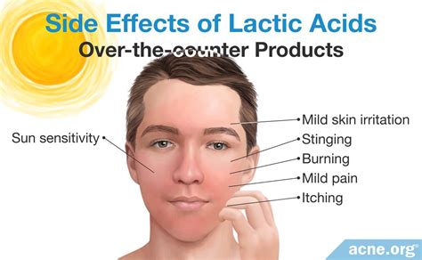 How Lactic Acid Helps With Acne