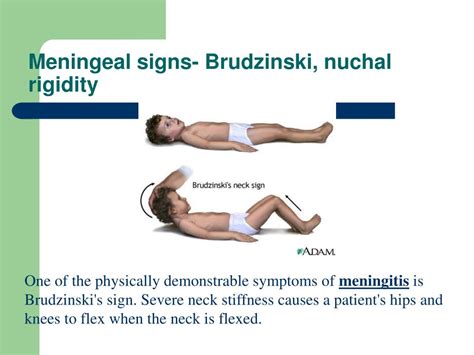 PPT - Neurosensory: Altered Cerebral Function and Increased ...