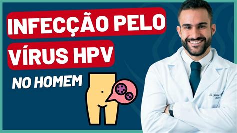 INFECÇÃO PELO VÍRUS HPV NO HOMEM PAPILOMAVÍRUS HUMANO DR MATHEUS