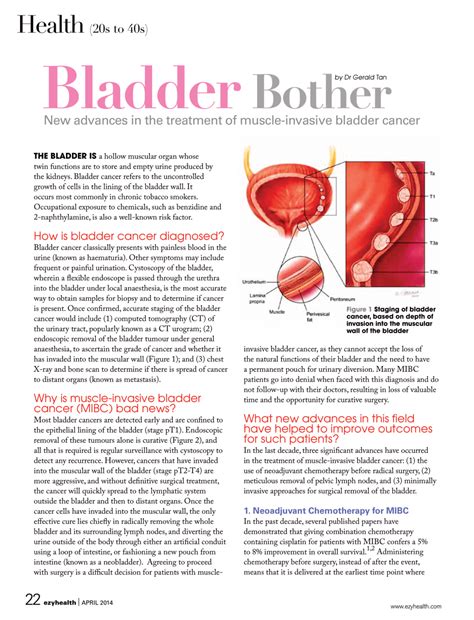 Aggressive Bladder Cancer | Advanced Urology