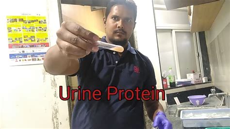 Urine Protein Test Procedure Youtube