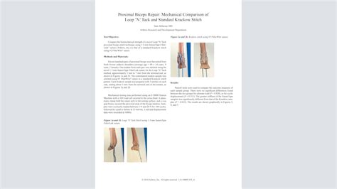 Arthrex T Cnica Para Tenodesis Del B Ceps Loop N Tack