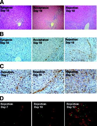 Histology Analysis Of 8 OHdG Expression In Liver Sections From Syngenic