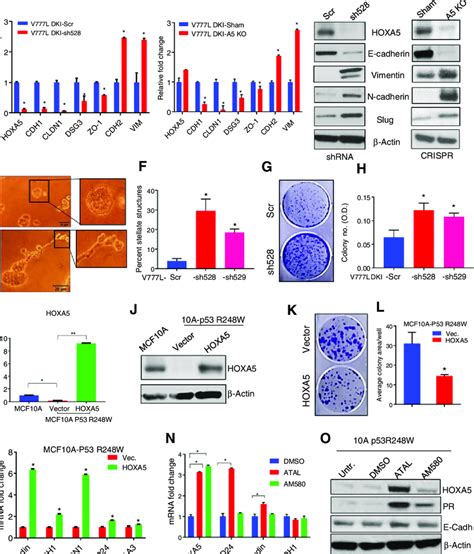 Ablation Of Hoxa Results In Emt And Restoration Of Hoxa Reverses Emt