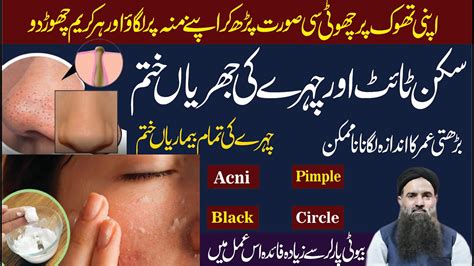 Chehre Ki Chaiyan Khatam Karne Ka Tarika Face Beauty Tips Acni