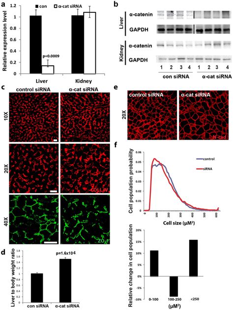 Specific knockdown of α catenin in liver induces major alterations to