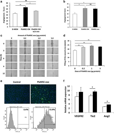 Angiogenic Activity Of Plamsc Exo A Endothelial Tube Formation Assay