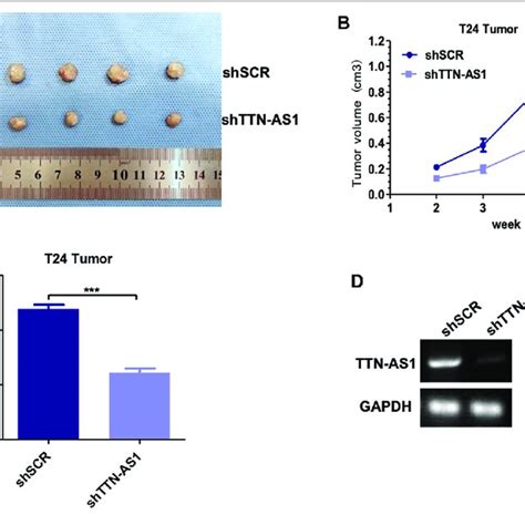 Knocking Down Lncrna Ttn As1 Inhibits The Growth Of Bladder Tumors In