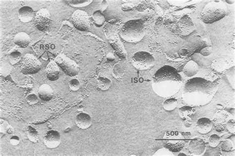 Freeze Fracture Electron Micrograph Of Liver Plasma Membrane