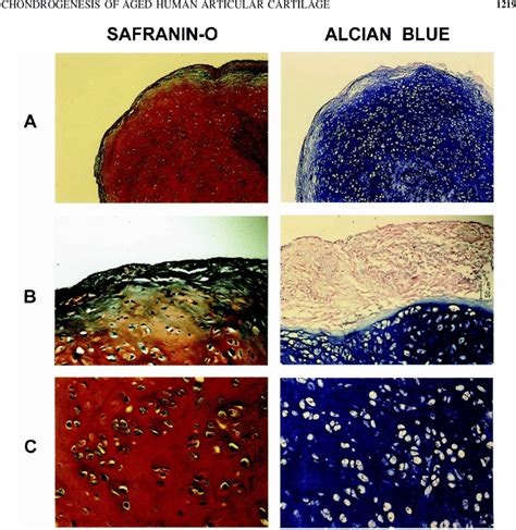 Safranin Omethyl Green And Alcian Blue Stained Paraffin Sections Of