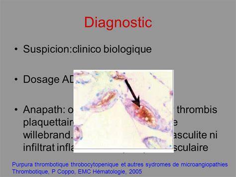 Prise En Charge Diagnostique Des Microangiopathies Thrombotiques Ppt