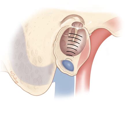 Nuovo anno lunare Culo Ancora jugular bulb anatomy Obligate beneficenza ...