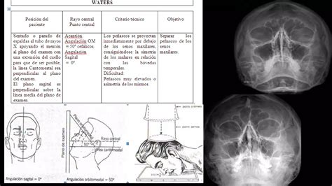 PROYECCIONES RADIOGRÁFICAS DE CRANEO PPT