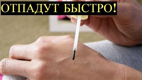 Это Копеечное средство из Аптеки поможет избавиться от Папиллом и ...