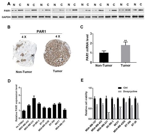 Par Is Upregulated In Human Breast Cancer A Western Blot Analysis