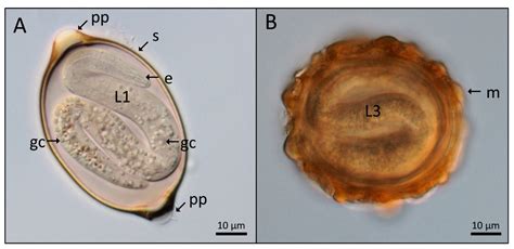 Ascaris Lumbricoides Anatomy External