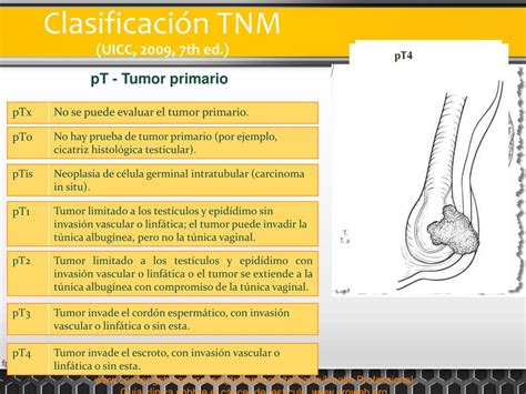 Ppt CÁncer Testicular Diagnostico Y EstadificaciÓn Powerpoint Presentation Id 2178247