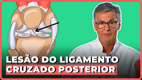 Tudo Sobre Les O Do Ligamento Cruzado Posterior Simplificando