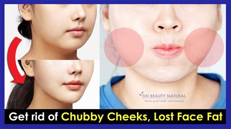 How To Get Rid Of Face Fat Cheeks Flash Sales | www.katutekno.com