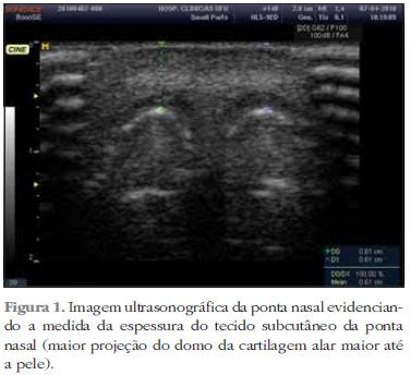 Scielo Brasil Avalia O Da Reprodutibilidade Ultrassonogr Fica Como