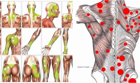 Myofascial Trigger Points Artofit