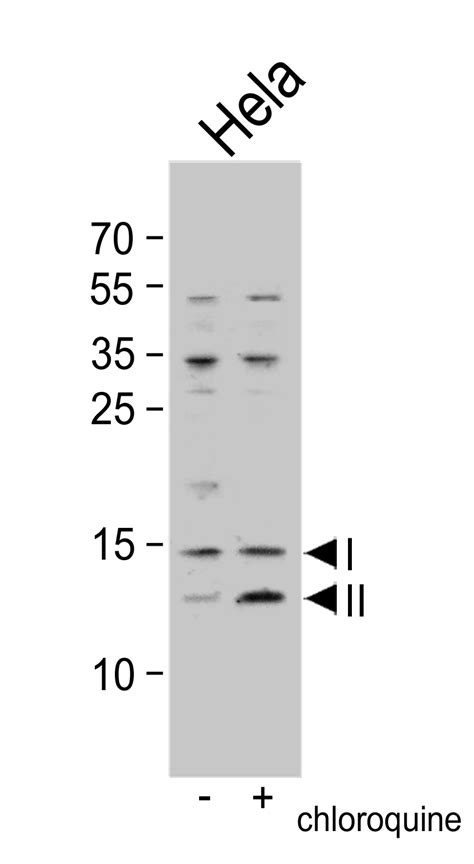 Rabbit Anti Lc Polyclonal Antibody N Term Absin