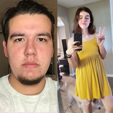 2018 Vs 2020 1y 5 Mo Hrt Transtimelines Transgender Girls Female Transformation Male To