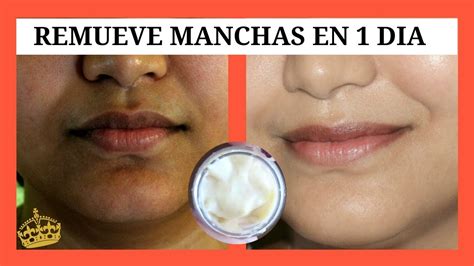 Arriba 82 Imagen Recetas Para Quitar Las Manchas Dela Cara Abzlocal Mx