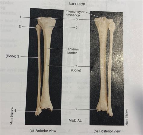 Right Tibia Fibula And Patella Diagram Quizlet