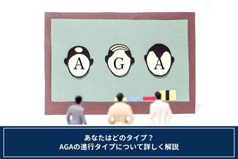 あなたはどのタイプ？agaの進行タイプについて詳しく解説 オンライン診療・服薬指導サービス Sokuyaku（ソクヤク）