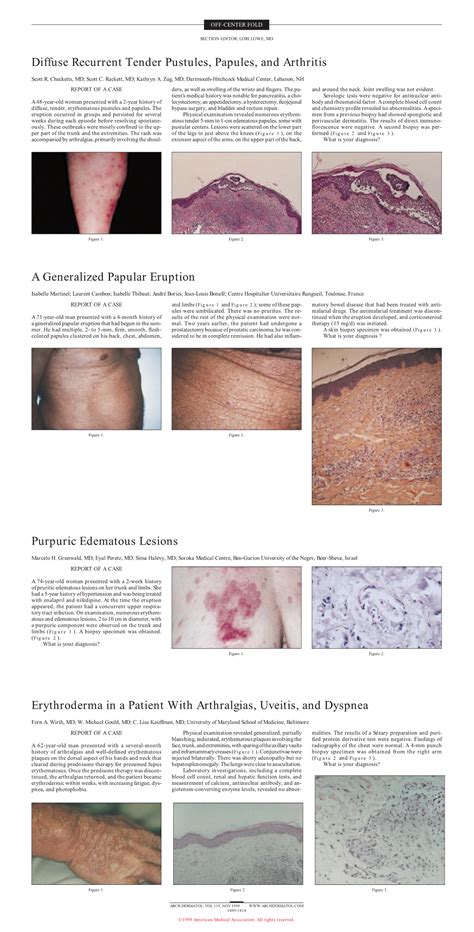 Diffuse Recurrent Tender Pustules Papules And Arthritis Dermatology