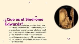 SINDROME DE EDWARDS..pptx