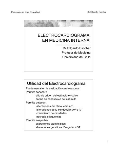 Pdf Electrocardiograma En Medicina Interna Alteraciones Del Ritmo