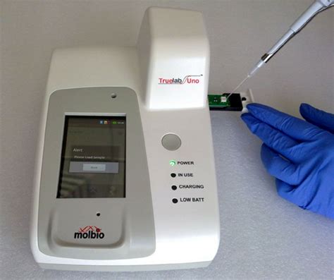 TB Diagnostic Kit Truenat Civilsdaily